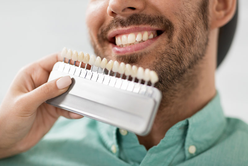 dental veneers patient smiling