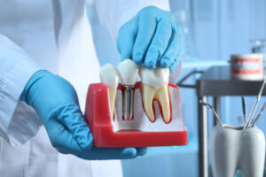 The image shows a person in blue gloves holding a dental implant model next to natural teeth, demonstrating how dental implants work. The setting appears to be a dental clinic.
