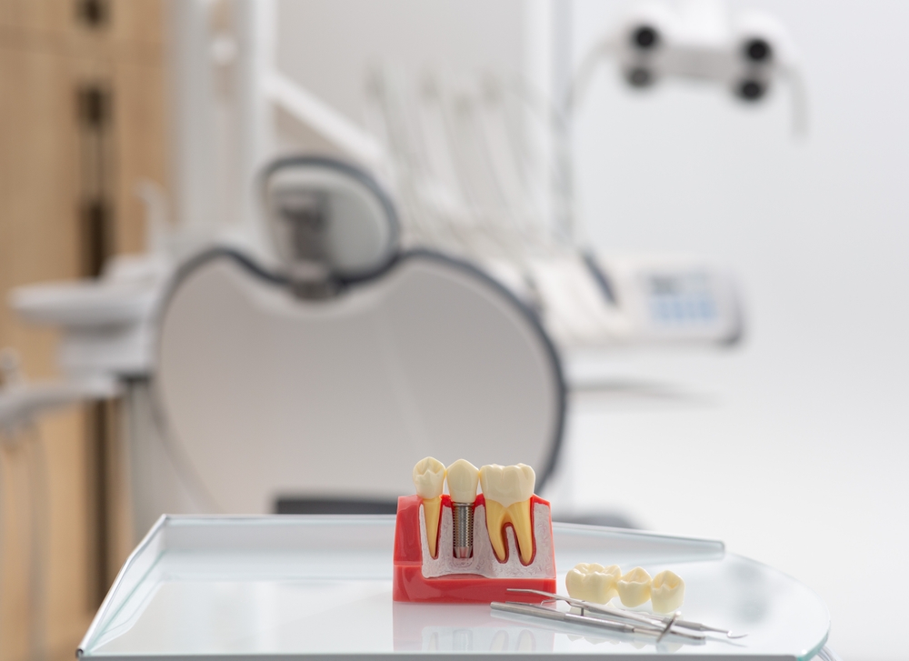 A close-up image of a dentist carefully placing a dental implant incisor into the mouth of a smiling patient. The focus is on the precision and artistry of the procedure, highlighting the natural look and feel of the replacement tooth. No text on the image.