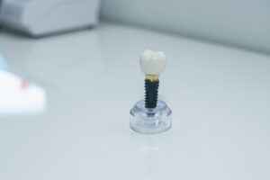 Patient and dentist discussing dental implant treatment in a modern dental office.