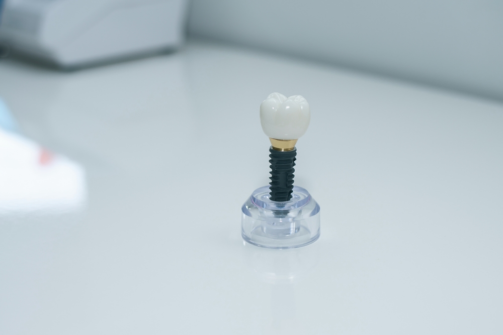 Patient and dentist discussing dental implant treatment in a modern dental office.